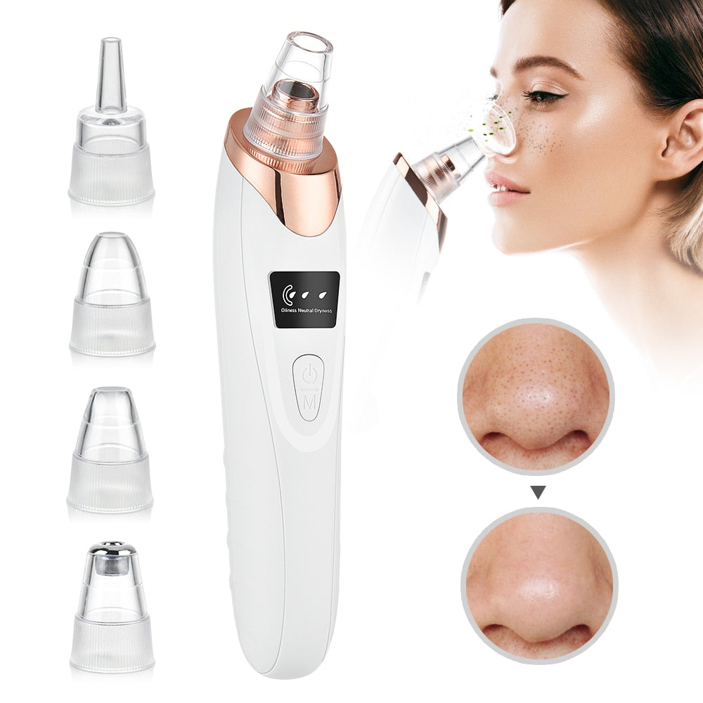 Electric Acne & Blackhead Remover Vacuum